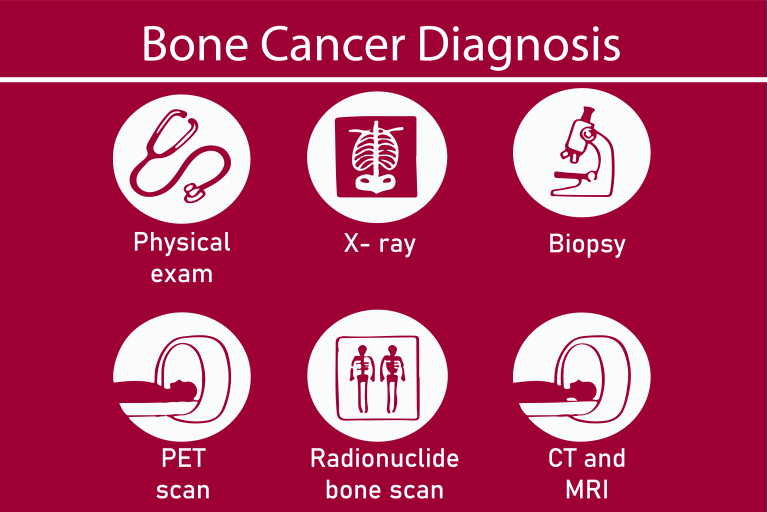 Bone Cancer - Estecharat